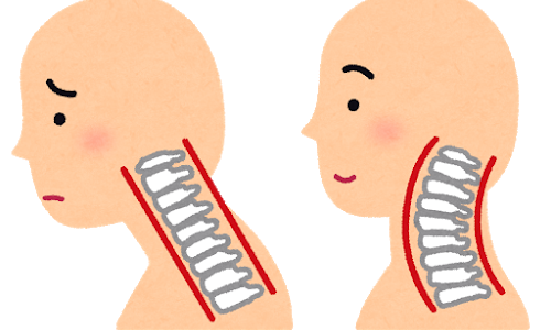 健康カプセル!ゲンキの時間:クィーンラインスエクササイズのやり方！首の痛み・シワ大改善